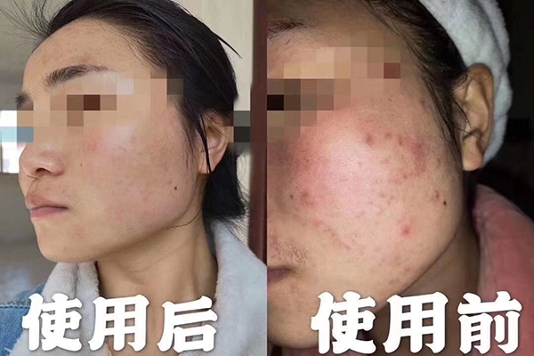 精油能喝嗎？不是所有精油都能喝-歐泉生化